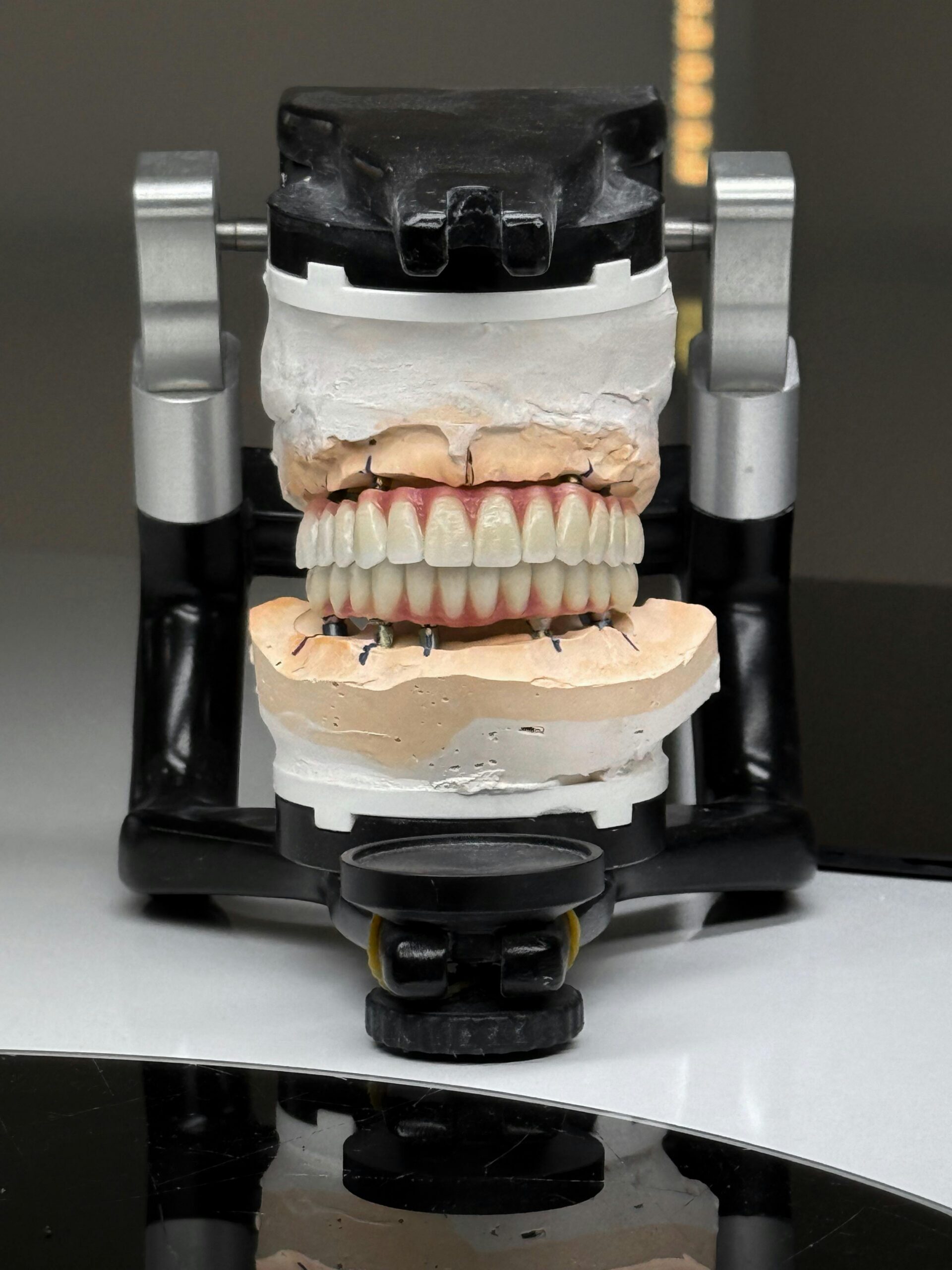 Realistic dental model on articulator, ideal for dental lab demonstrations.