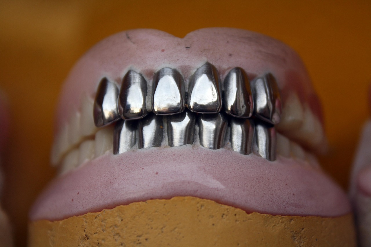 metal teeth, dental, denture, orthodontic, mouth, oral, brown teeth, dental, dental, denture, denture, denture, denture, denture, orthodontic